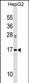 MYL6 Antibody (Center)