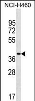 ZNF488 Antibody (Center)
