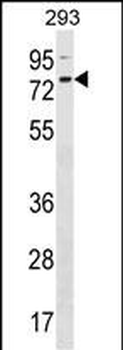 ZNF416 Antibody (C-term)