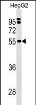 SEPSECS Antibody (C-term)