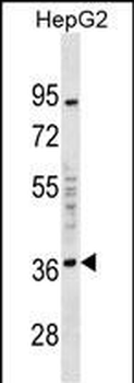 EDA2R Antibody (C-term)