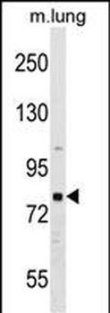 RHPN1 Antibody (C-term)