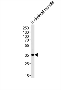 PPP1R3B Antibody (C-term)