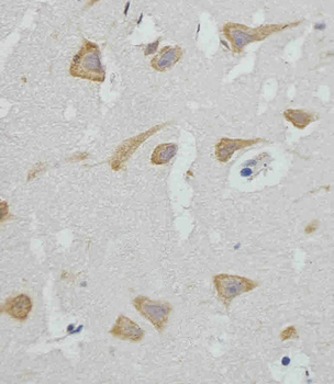GABARAP Antibody (N-term)