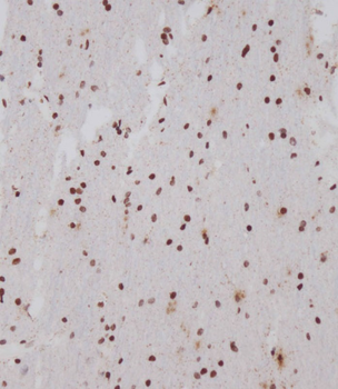 OTUD7A Antibody (N-term)