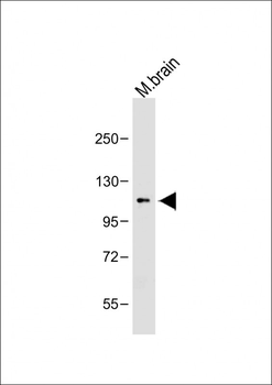 OTUD7A Antibody (N-term)