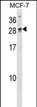 LIPT2 Antibody (N-term)