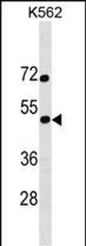 SS18L1 Antibody (Center)
