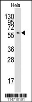 ATG16L Antibody