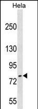 FASTKD3 Antibody (C-term)
