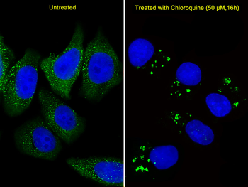 ATG5 Antibody (C-term)