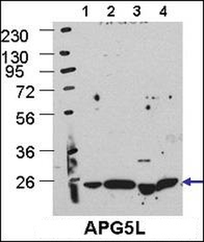 ATG5 Antibody (C-term)