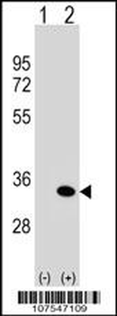 ATG5 Antibody (C-term)