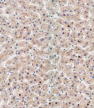 ATG5 Antibody (N-term)