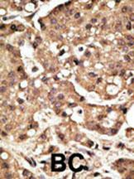 ATG4C Antibody (C-term)