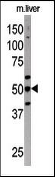 ATG4C Antibody (N-term)