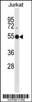 ATG4C Antibody (N-term)