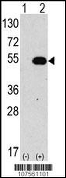 ATG4C Antibody (N-term)
