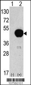 ATG4B Antibody (C-term)