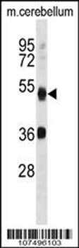 ATG4B Antibody (N-term)