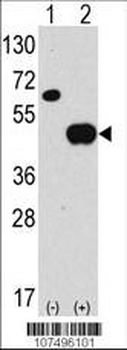 ATG4B Antibody (N-term)