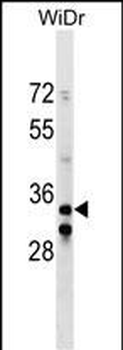 ITGB1BP2 Antibody (C-term)