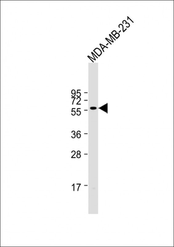 ONECUT3 Antibody (C-term)