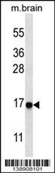 Cleaved LC3A Antibody