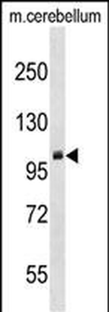 PRMT10 Antibody (N-term)