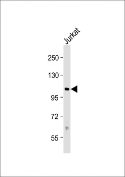 PRMT10 Antibody (N-term)