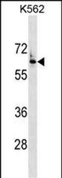 FZD7 Antibody (Center)