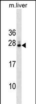 DNAJB9 Antibody (N-term)