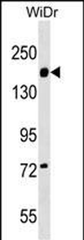 ITGA2 Antibody (C-term)
