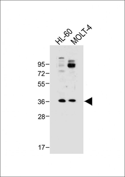 RQCD1 Antibody (Center)