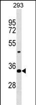 Mouse Hoxd9 Antibody (Center)