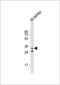 Mouse Hoxd9 Antibody (Center)