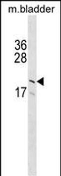 GP9 Antibody (C-term)