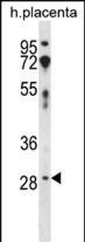 CD200 Antibody (C-term)