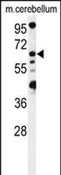 MON1B Antibody (C-term)