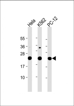 LZIC Antibody (Center)