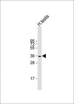 WBP2NL Antibody (N-term)