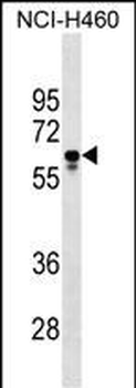 PGS1 Antibody (Center)