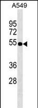 ZFP36L2 Antibody (Center)