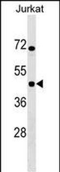 IKBIP Antibody (C-term)