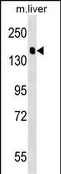 PPFIA2 Antibody (Center)