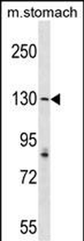 AGTPBP1 Antibody (N-term)