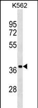 UBLCP1 Antibody (C-term)