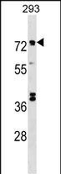 IL20RA Antibody (Center)
