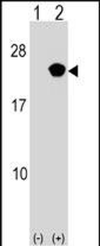 RAP2B Antibody (Center)