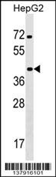 KCTD13 Antibody (C-term)